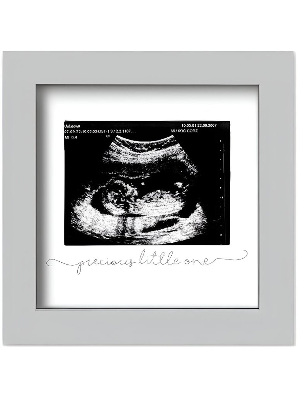 Baby Sonogram Picture Frame - Pregnancy Announcement Photo Frames(Cloud Gray)